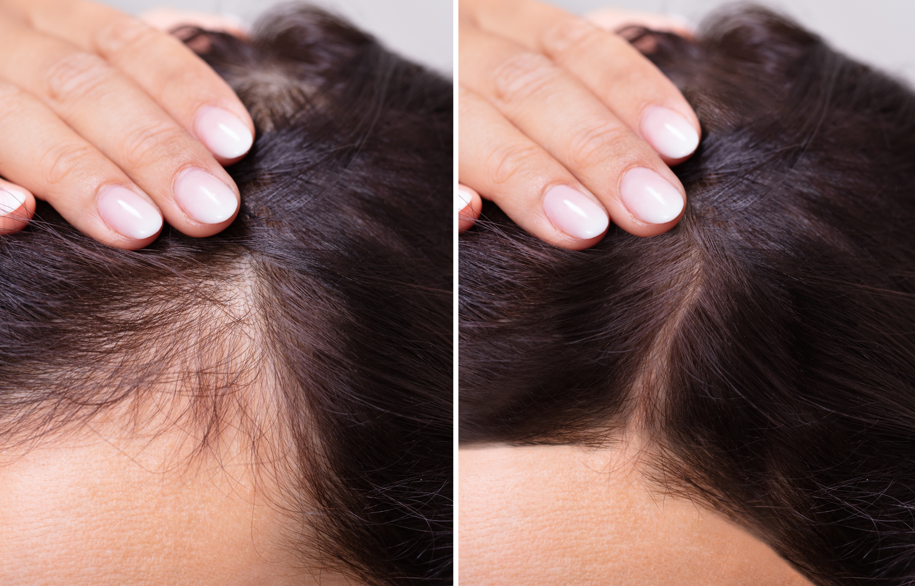 HairPulse Comb 30 before after 1 FLOWADO