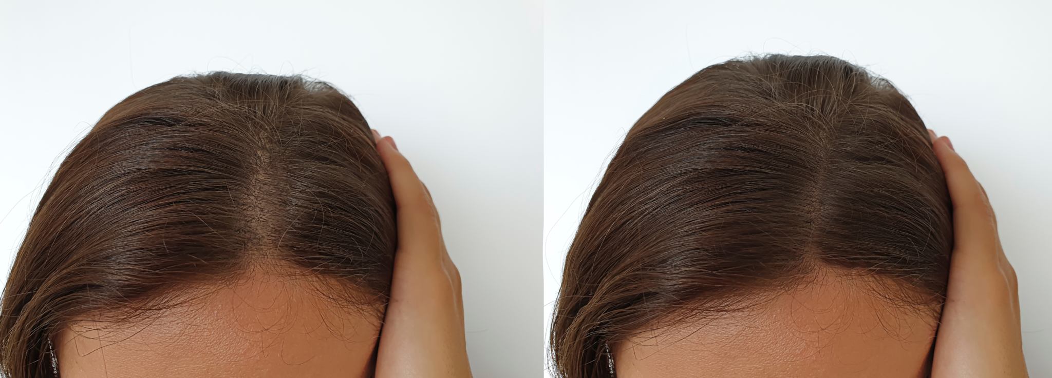HairPulse Comb 26 before after 2 FLOWADO